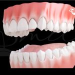 Periodoncia 1