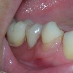 IMG_0127